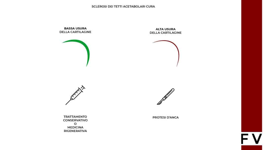 andare in bicicletta con sclerosi del tetto acetabolare